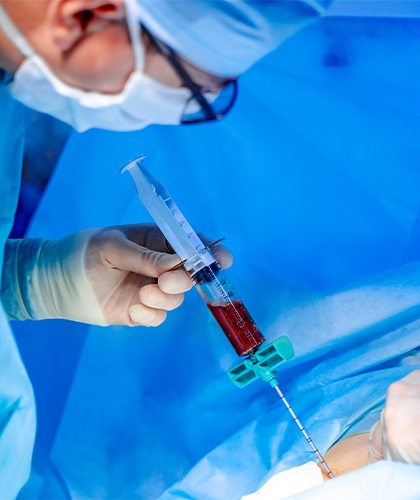 Bone marrow transplantation
